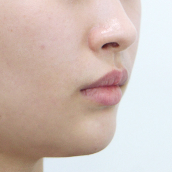 BL220402_Chin_2After